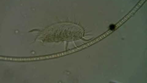 Euplotid Ciliate with big cirri