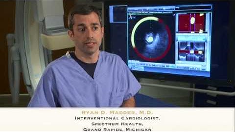 Detection by NIRS of Large Lipid Core Plaques at Culprit Sites in Patients with Acute STEMI
