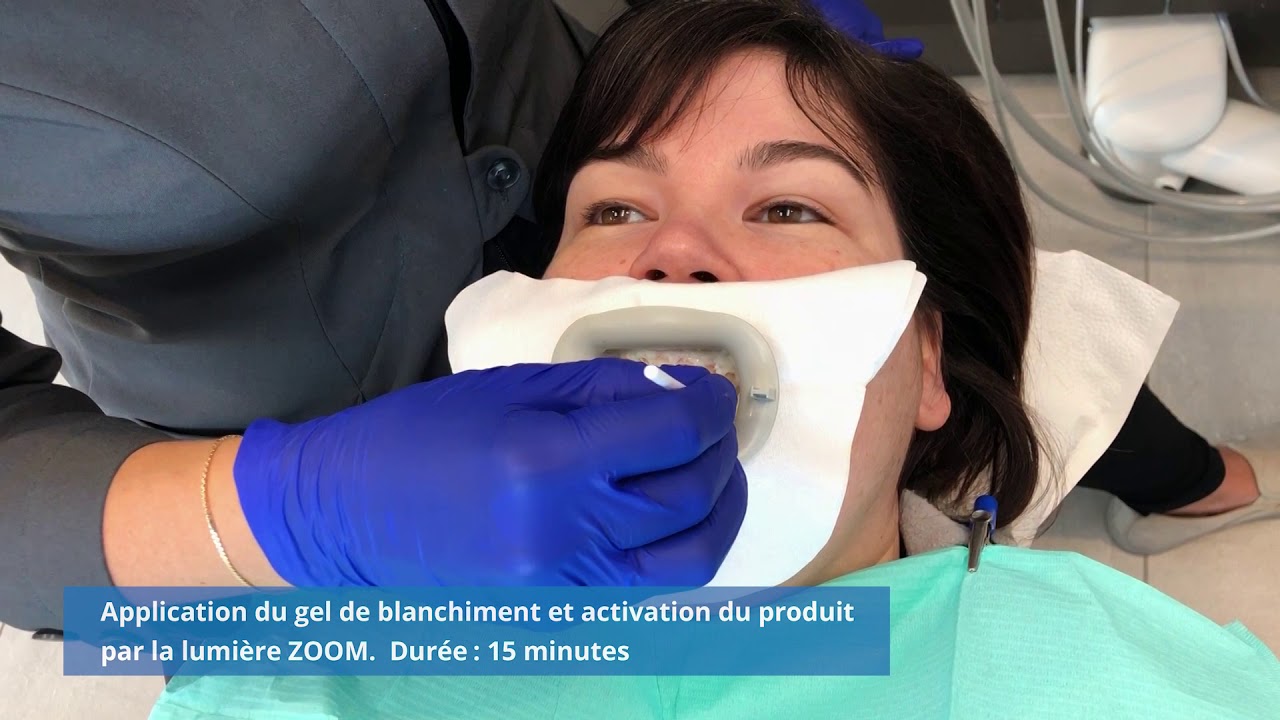 Blanchiment dentaire Zoom - Centre dentaire St-Onge