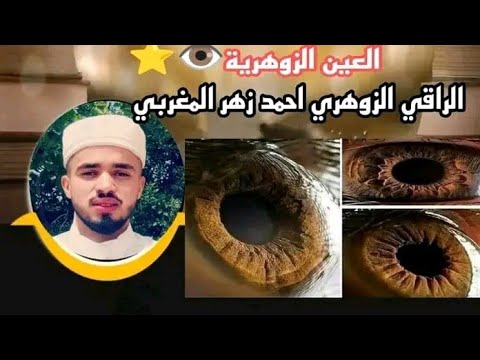 زوهري العين علاماته وصفاته وقدراته معلومات مفيدة مع نصائح لزوهري 