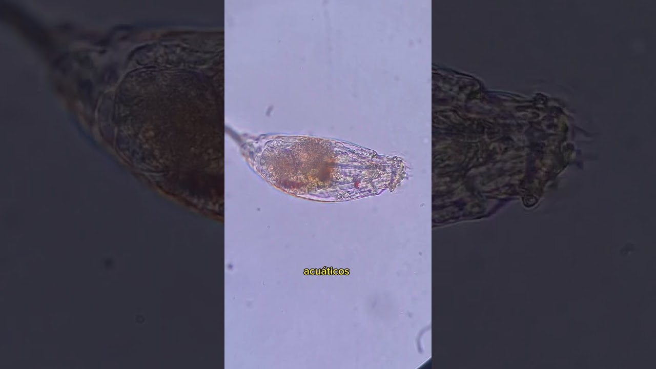Encontramos Rot&iacute;feros En Una Muestra De Orina