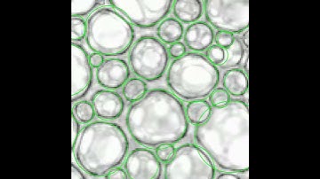 Deep learning for bubble detection