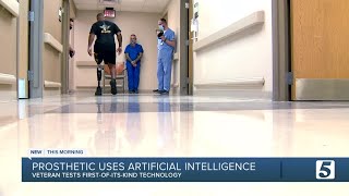 Nashville VA Medical Center one of 'a handful' of hospitals to use new type of prosthetic