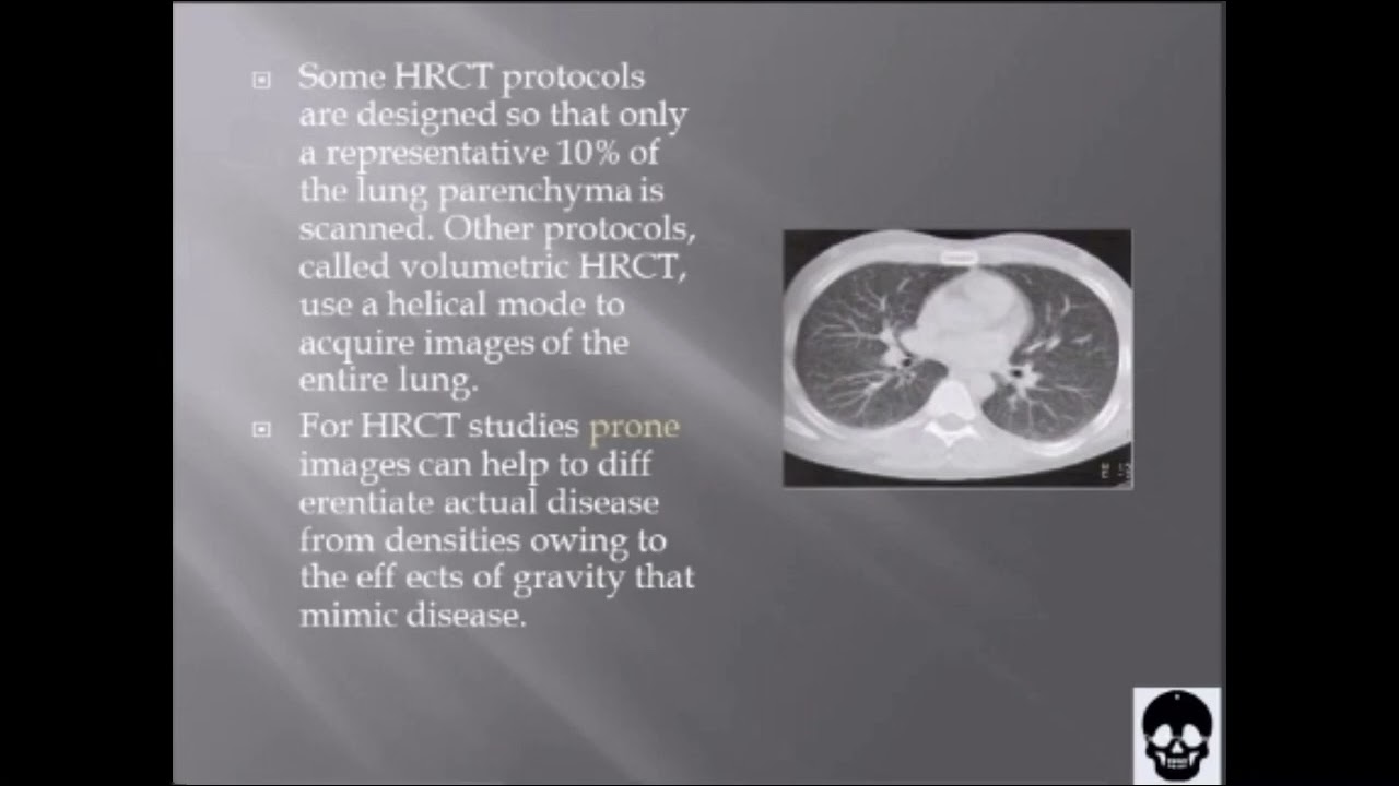 Chest CT Protocol and Imaging Procedures