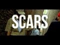 Scars - CCG AON Exclusive / Prod & Shot by @DjKenn_AON