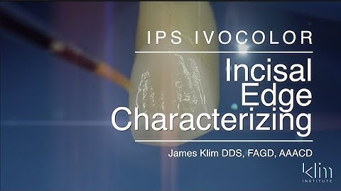 Anterior e.max Ivocolor Stain and Glaze Technique