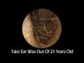 Take Ear Wax Out Of 21 Years Old With Relaxing Music