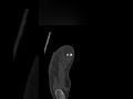 👀 Dive into the world of MRIs! Check out this cool foot scan from top to bottom