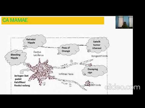 Video: Interaksi Tumor-stromal: Integrin Dan Adhesi Sel Sebagai Modulator Kelangsungan Hidup Dan Transformasi Sel Mammae