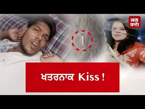 Wife Cut Husband Tongue While Doing kiss In Delhi