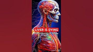 LIVER is DYING! 5 Weird Signs of Live #|part2 | Learn Daily
