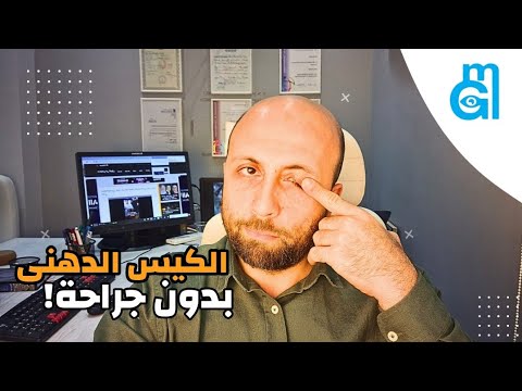 الكيس الدهنى طرق العلاج المنزلية بدون عملية