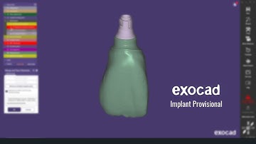 Exocad Implant Provisional Tutorial