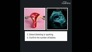 The 6 Week Pregnancy Ultrasound Scan Importance And What To Expect