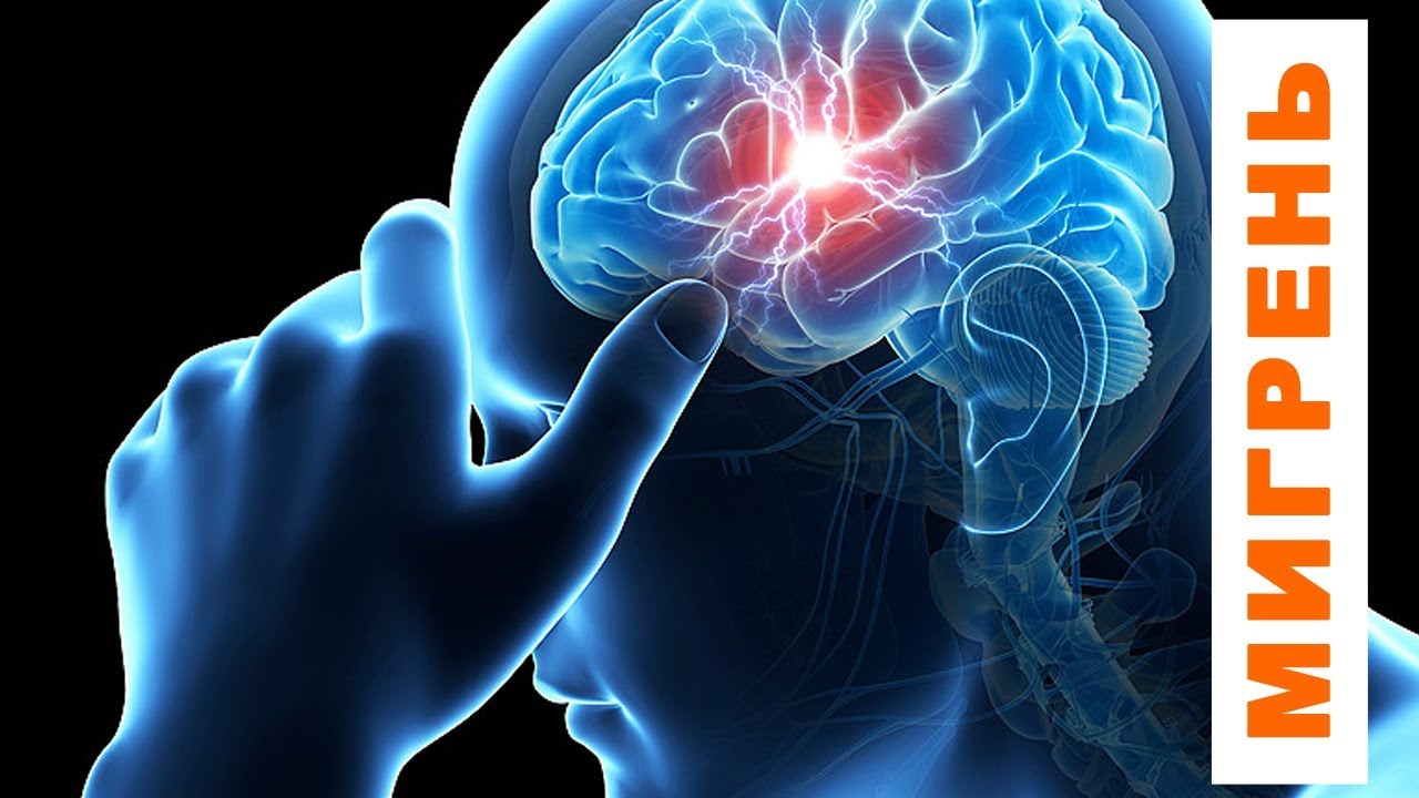 Мигрень с аурой причины лечение - YouTube