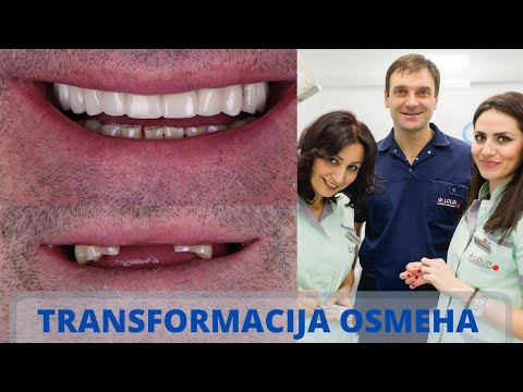 Video: Protetika Zubne Krunice