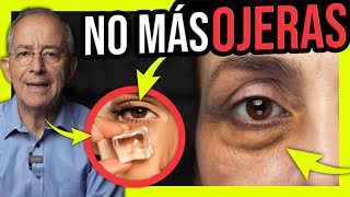 Thumbnail image for 👁️ OLVIDATE De Las OJERAS Con SOLUCIONES EFECTIVAS Y NATURALES - Oswaldo Restrepo RSC