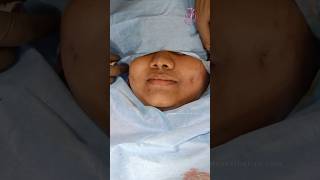 Get Natural Dimples in Minutes? | Dimpleplasty | Pink Apple Aesthetics #bangalore