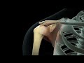 Reparación artroscópica del manguito de los rotadores