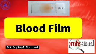 Blood Film أسرع وأسهل طريقة لعمل