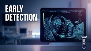 First Trimester Ultrasound Guide: NT Measurement, Nasal Bone & Doppler Technique screenshot 5