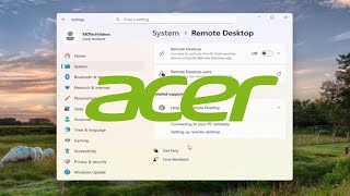 How to Enable Remote Desktop on Acer Laptop [Guide]