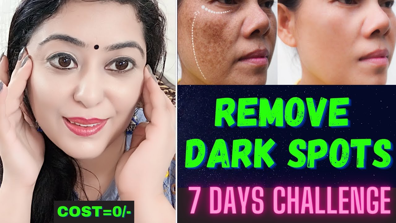 मुश्किल से मुश्किल DARK SPOTS झाइयाँ HYPERPIGMENTATION BROWN SPOTS का इस तरीके से करें 100% इलाज