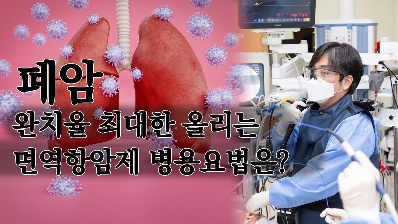 폐암 완치율 최대한 올리는 면역항암제 병용요법은?