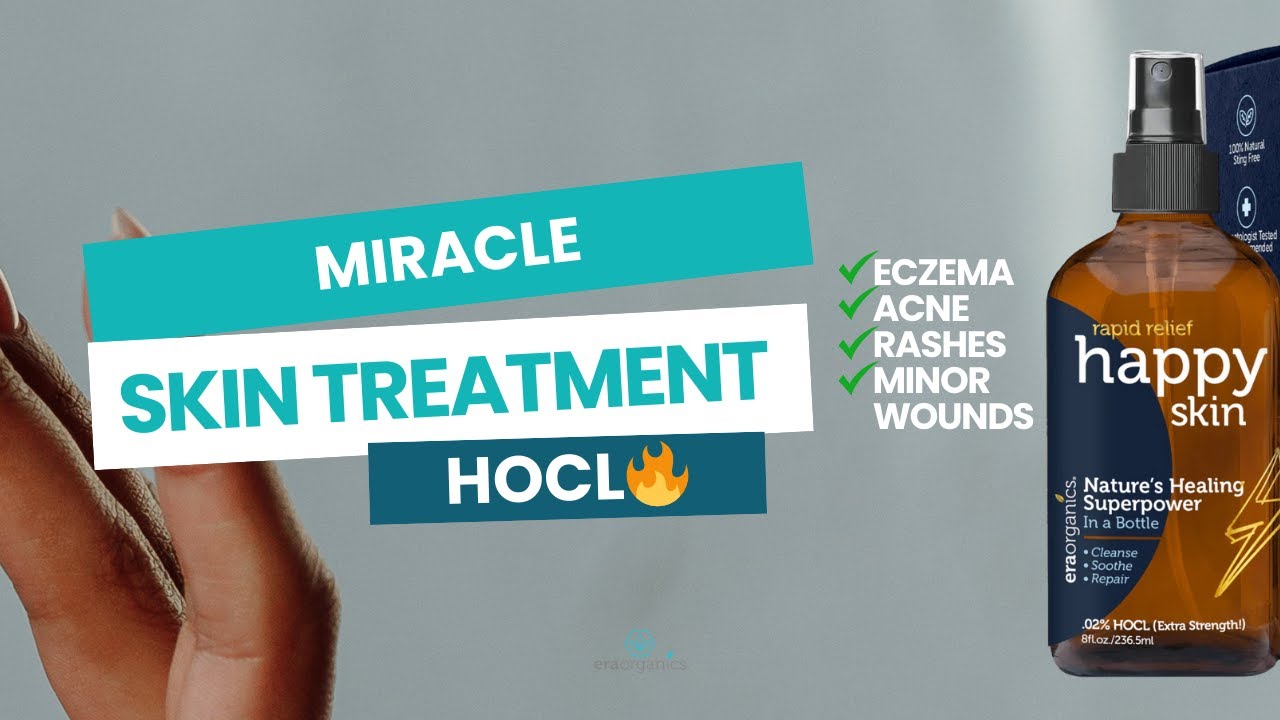 Hypochlorous Acid: The Skincare Secret You NEED to Try! (Acne, Eczema & More)