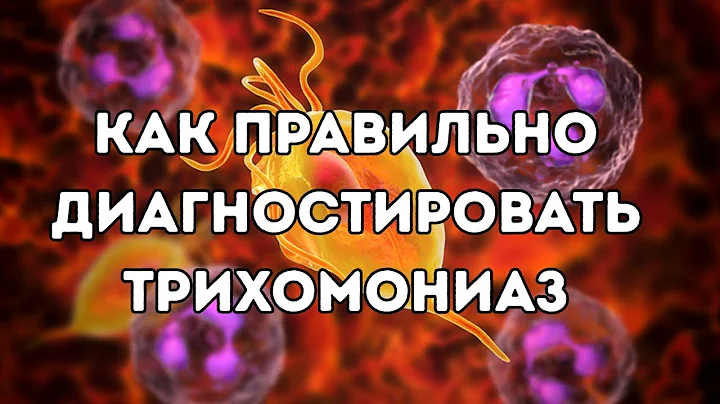 Как правильно диагностировать трихомониаз #доказательнаямедицина #doctorberezovska #трихомонады
