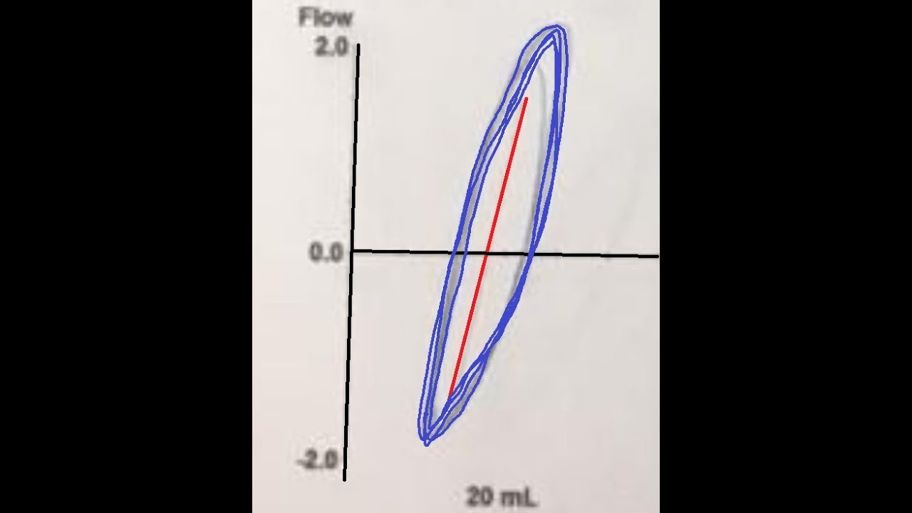 Como se realiza los VOLÚMENES PULMONARES, PLETISMOGRAFIA pulmonar