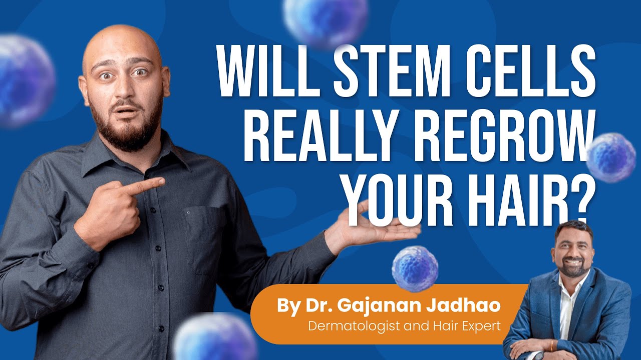 Stem Cells Therapy