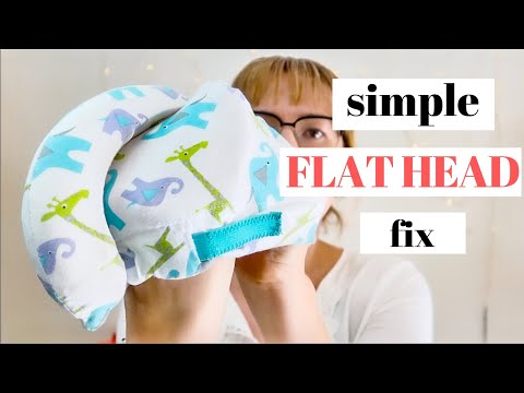 It was SO SIMPLE! | How we fixed my baby&rsquo;s FLAT HEAD and avoided the HELMET | Flat head fix