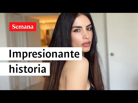 Impactante historia: el día que Jessica Cediel descubrió que tenía biopolímeros