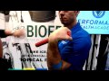 Proven Exercises for Elbow Pain