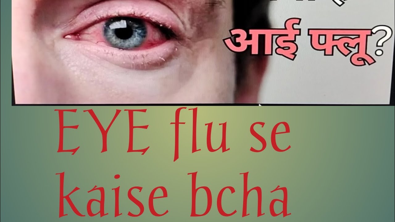 eye flu ya eye allergy se bachne ke upay YouTube