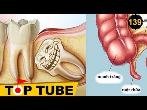 Top 10 Bộ Phận Cực Kỳ Vô Dụng Trên Cơ Thể Con Người [Top tube 139]