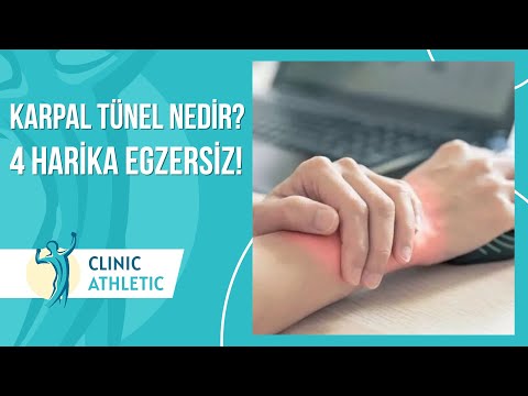 Karpal Tünel Sendromu Nedir? Neden Oluşur? | 4 Harika Egzersiz!