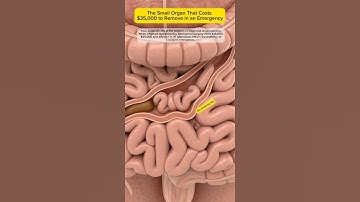 The Small Organ That Costs $35,000 to Remove in an Emergency