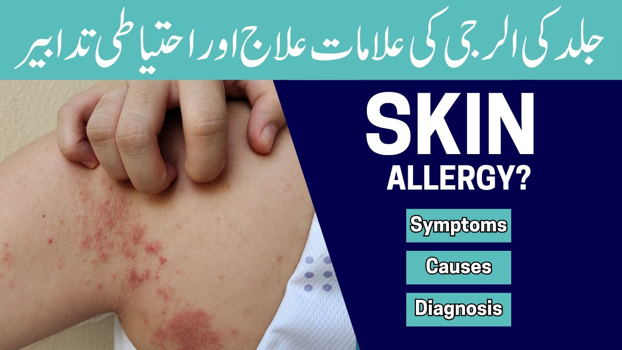 Skin Allergies: Types, Symptoms & Causes Revealed! - YouTube