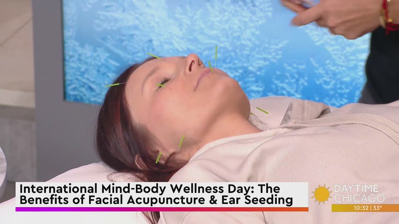International Mind-Body Wellness Day: The Benefits of Facial Acupuncture & Ear Seeding