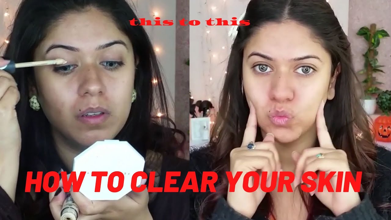 THIS PRODUCT CLEARED MY SKIN IN 2 MONTHS || Beenish khan - YouTube