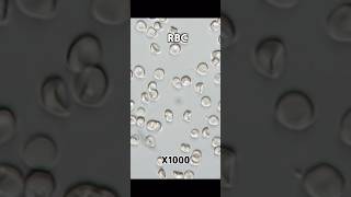 현미경속 신기한 소변세계5 Rbc