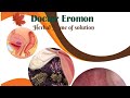 Get rid of endometriosis with dr eromon herbal remedies