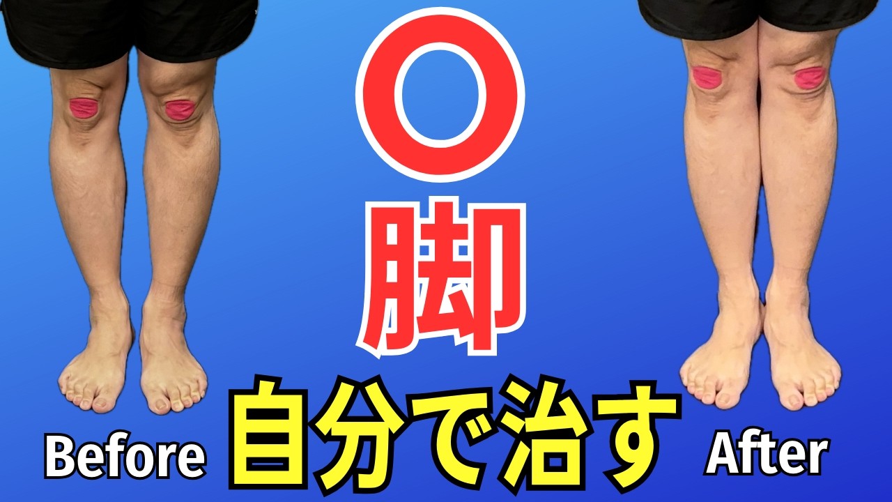 O脚の方必見！】9割の人が間違えているO脚の治し方 | 大阪市都島区 さ