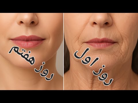 لیفت خط فک وکات گونه رفع غبغب رفع خط خنده بدون عمل های سنگین با ماساژ های تخصصی