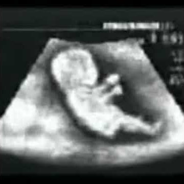Bayi lucu bawa mobil dalam perut