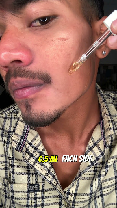 Day 15 Of Using Man Matters Minoxidil 5% for Beard Growth 😉 #beardgrowth #minoxidilresult #viral