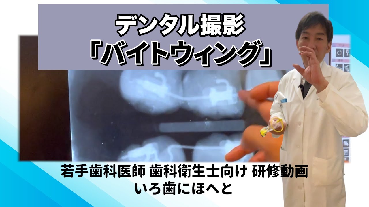 【歯科医院】研修動画│デンタル撮影「左上奥歯の角度」