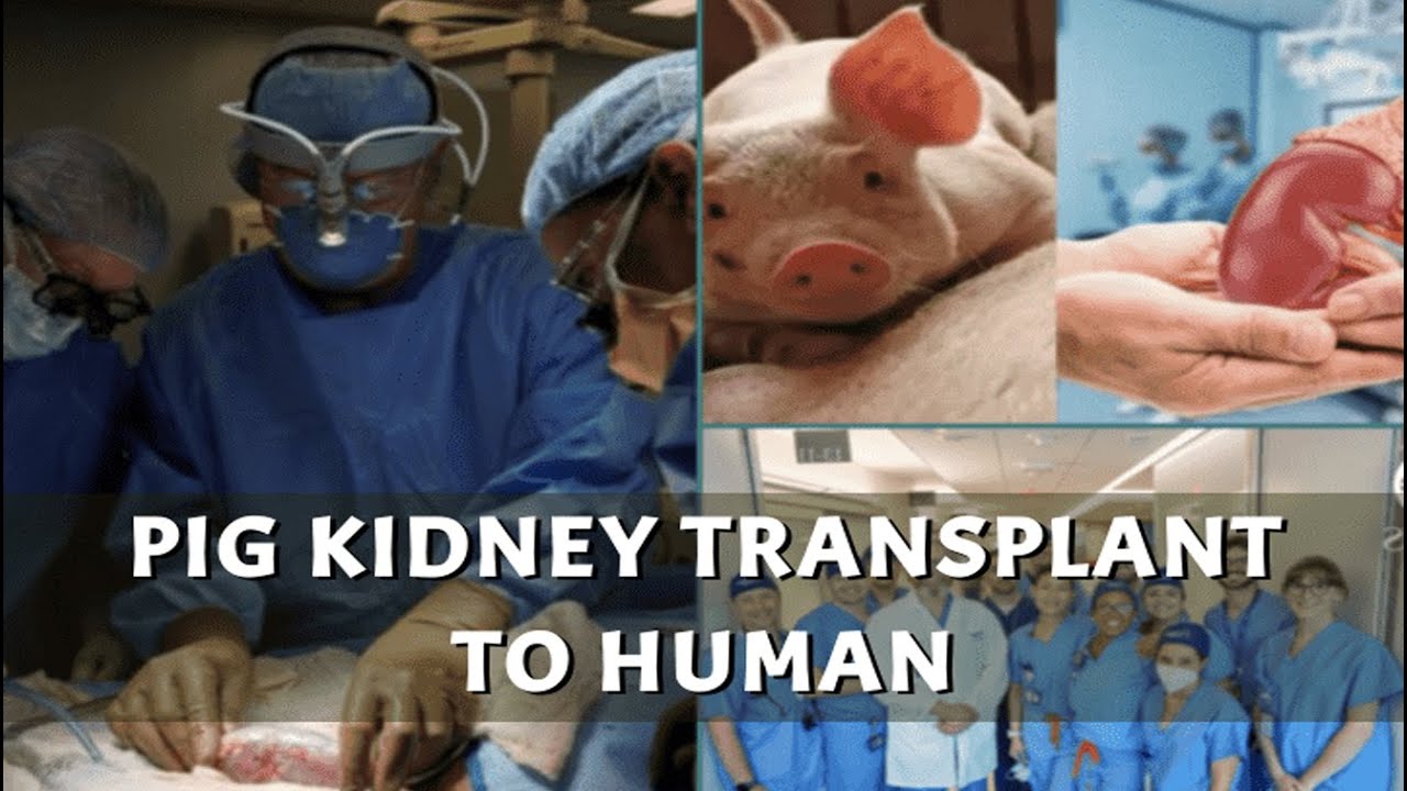 Doctor comments on pig kidney transplant to human Andhra Pradesh